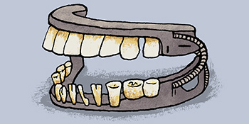 mountvernon-dentures-350x175